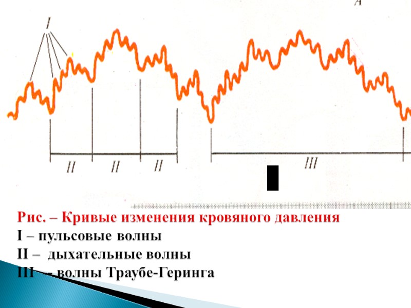 Рис. – Кривые изменения кровяного давления I – пульсовые волны II –  дыхательные